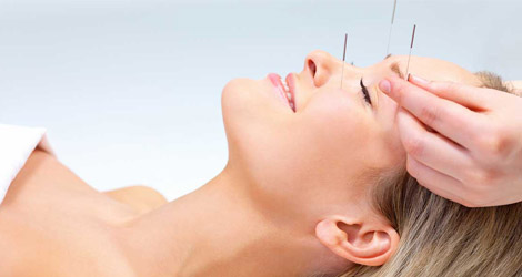 Acupuncture